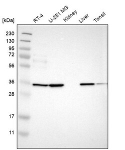 TMEM51 Antibody, Novus Biologicals 25 &mu;L; Unlabeled:Antibodies, Polyclonal
